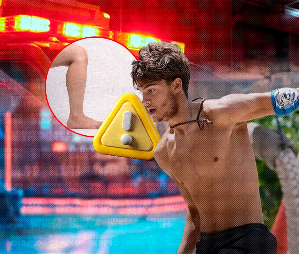 Suspensión temporal de ‘Survivor Grecia’ en RD tras grave accidente de un participante