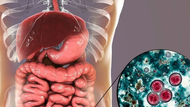 Brote de Cyclospora expone fallas de vigilancia sanitaria en EE.UU.; mientras crecen los casos sin origen claro
