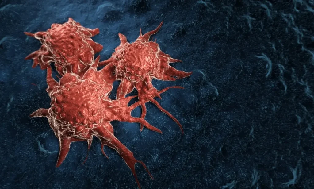 Más microplásticos en pulmón de pacientes con cáncer avivan el reclamo por controles